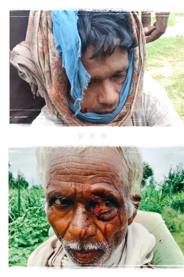 Lakhimpur Kheri news : आंवला वनचौकी क्षेत्र में बाघ का हमला पिता-पुत्र गंभीर, जिला अस्पताल रेफर; गांव में दहशत का माहौल